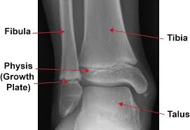 Image result for Growth Plate