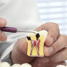 Image result for Pulpitis