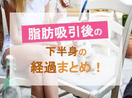 ベイザー脂肪吸引 下半身の経過まとめ ベイザー脂肪吸引ラボ 脂肪吸引 脂肪 下半身