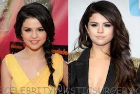 Have You Heard About Selena Gomez Plastic Surgery The Celebrity Plastic Surgery African Braids Hairstyles Nose Job Selena Gomez