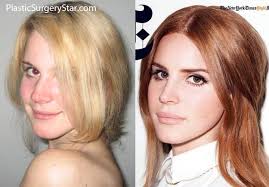 Eyelid Surgery Salt Lake City Blepharoplasty Utah Ogden Cost Plastic Surgery Nose Job Injectables Fillers