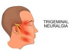 Pin On Acupuncture