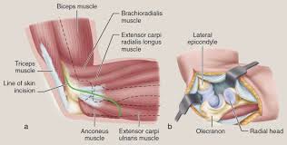 Image result for Septic Joint
