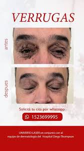 Billede af Universo Láser (@universo.laser) · 30. oktober 2021