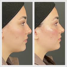 Spokane Injector 💉| Chris Barsh (@chris_barsh_arnp) • Instagram photos and  videos