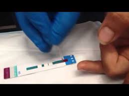 Hiv Rapid Test Farmer Dave Youtube