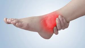 The achilles tendon is a fibrous cord of tissue that connects the muscles in the calves to the heel bone. How To Heal And Prevent Achilles Tendonitis Healthcare Athome