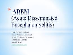Ms vs adem BASIC DIFFERENCES AND APPROACH