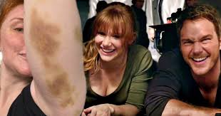 Filming has resumed on the upcoming threequel. Bryce Dallas Howard Shows Off Nasty Bruises From Jurassic World 3 Set