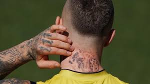 I am currently a tattoo apprentice from iowa. Tattoo Regret Why Tattoo Removal Clinics Are On The Rise The Courier Mail