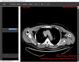 Dicom is an acronym for digital imaging and communication in medicine, and it's a powerful free medical software that media freeware developed for windows devices. 12 Best Free Windows Dicom Viewer Softwares Wpshopmart
