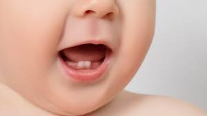 Wann bekommt mein baby seine zähne und in welcher reihenfolge? Zahnungsprobleme Bei Babys