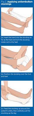 How To Apply Antiembolism Stockings To Prevent Venous Thromboembolism Nursing Times