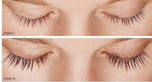 Lumigan 0.03% Eye Drops 3 Ml Price In Pakistan- Medicalstore.Com.Pk