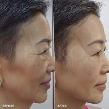 Good skin specialist in klang valley? Ko Skin Specialist Klang Skin Specialist In Klang