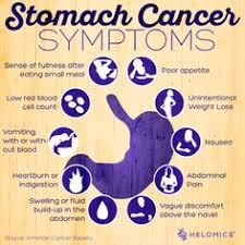 Stomach cancer symptoms in women include blood in stools, loss of appetite, stomach pain, difficulty in swallowing, etc. Sam