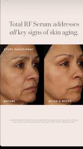 Wendi K. McGlamery Premier LEVEL V EC, Rodan + Fields