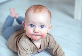 Skin Rashes In Children Symptoms Causes Treatment