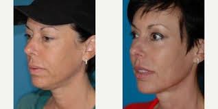 Ben J. Tittle, MD, Board Certified Plastic Surgeon