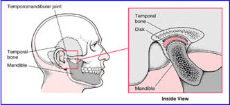 Pin By Its Yours On Ears Tmj Tmd Tmj Merck Manual Arthritis Causes