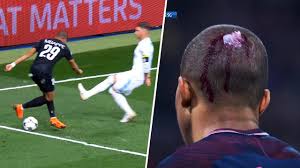 Neymar jr and kylian mbappe funny moments, prank mbappe, failed, skills. 10 Horror Tackles On Kylian Mbappe Youtube