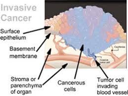 These turn a healthy cell into a cancerous cell. Seer Training What Is Cancer