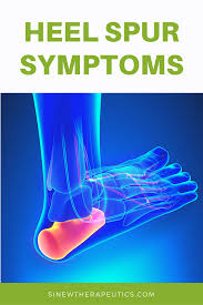 Pin By Teresa Busch On Foot In 2020 Heel Spurs Heel Spurs Symptoms Heel Spurs Remedies