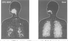 Figure 3 from Inhaled corticosteroids for adult asthma: impact of  formulation and delivery device