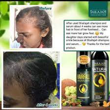 While oiling and washing helps get rid of any dirt and grime in the hair, it does not really protect the hair from environmental damage. Sailajah Hair Serum And Syampoo Shopee Malaysia