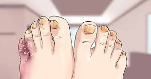 Pin On 14 Symptomes Du Diabete