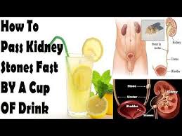 Pin On Natural Home Remedies