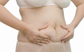 Active breast feeding, additionally helps to reduce accumulated fat. How To Tighten Loose Skin After Pregnancy