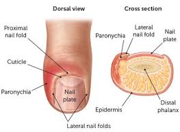 Image result for paronychium