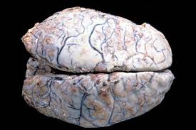 Http Www Uks Eu Fileadmin Uks Einrichtungen Kliniken Und Institute Neuropathologie Entzuendliche Hirnerkrankungen Pdf