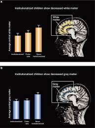 Group homes are longer term because of treatment, placement what is the premise behind shock incarceration that the youths sentenced will be? Early Adverse Experiences And The Developing Brain Neuropsychopharmacology