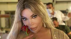 U emisiju doneo rebra koja je izvadio (foto, video). Reality Star Jessica Alves Hat Ein Loch Im Kinn