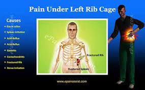 Picture of organs that sit upder left rib cage : Pain Under Left Rib Cage Treatment Causes Diagnosis