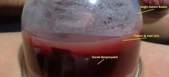We did not find results for: Bekam Sunnah Urut Bersalin Bekam Wanita
