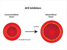 We did not find results for: Ace Inhibitors Mechanism Of Action Side Effects And Precautions