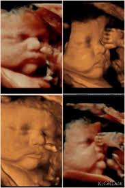 3D ultrasound and chubby babies! Post pics here
