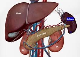 Image result for Splenomegaly