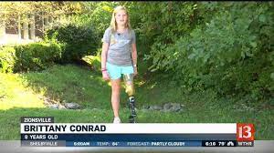 Brittany is taking on the world after losing her leg in a lawnmower  accident 