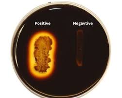 Starch Hydrolysis Test: Principle ...