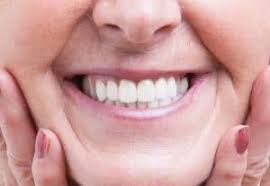 Lamine diş tedavisi estetik amaçlı uygulanan bir operasyon olup oldukça kısa sürer ve toplamda diş koltuğunda geçirilecek süre 30 dakikayı geçmez. Dis Kulubu Golden Smile Ailenizin Dis Hekimi