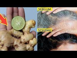 Dokter Terkejut Uban Hilang Selamanya Tanpa Semir Rambut Youtube Di 2020 Rambut Obat Alami Rambut Alami