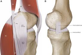 Medial collateral ligament knee anatomy. Surgical Repair Of Medial Collateral Ligament And Posteromedial Corner Injuries Of The Knee A Systematic Review Arthroscopy