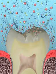 A Natural Cure For Cavities Be Boundless