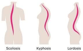 Drengen blev fundet ved sølyst kro af nogle forbipasserende. Ryggplager Er Vanlig Toyning Bidrar Til Mindre Stivhet Se Her Hvordan