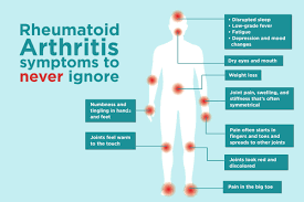 Rheumatoid arthritis is a systemic disease, meaning it can affect the entire body. Rheumatoid Arthritis Symptoms You Might Be Ignoring