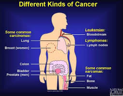 Bone marrow tests check to see if your bone marrow is working correctly and making normal amounts of blood cells. Bone Marrow Cancer Symptoms Health Care Fix